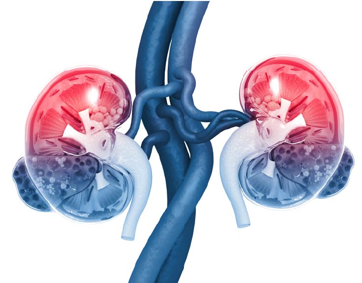 The scioAKI biomarker panel was developed as a basis for early and precise Acute Kidney Injury (AKI) diagnosis.